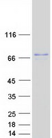 protp56181 ndufv3 human recombinant protein