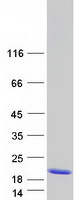 Coomassie blue staining of purified MTCP1 protein