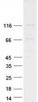 Coomassie blue staining of purified EVC protein