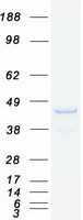 protp57768 snx16 human recombinant protein