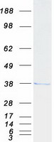 protp57796 cabp4 human recombinant protein