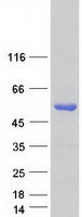 protp58012 foxl2 human recombinant protein
