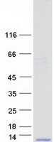 protp58062 spink7 human recombinant protein