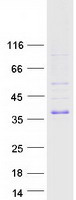 Coomassie blue staining of purified TIRAP protein