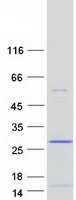 Coomassie blue staining of purified DSCR10 protein