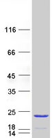 protp59282 tppp2 human recombinant protein