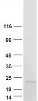 protp60321 nanos2 human recombinant protein