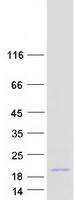 protp60568 il2 human recombinant protein