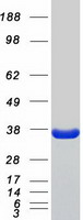 Coomassie blue staining of purified PRPS1 protein