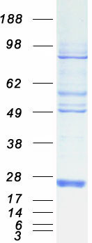 Coomassie blue staining of purified DSTN protein