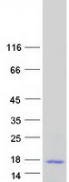 protp60985 krtdap human recombinant protein