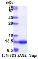 3ug by SDS-PAGE under reducing condition and visualized by coomassie blue stain.