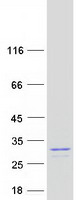 protp61086 hip2 ube2k human recombinant protein