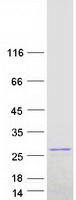 Coomassie blue staining of purified RAP1B protein