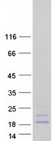 Coomassie blue staining of purified SST protein