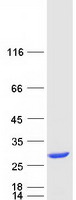 protp61758 pfdn3 vbp1 human recombinant protein