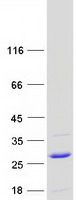 Coomassie blue staining of purified UBE2G1 protein