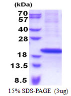 3ug by SDS-PAGE under reducing condition and visualized by coomassie blue stain.
