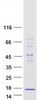 protp62316 snrpd2 human recombinant protein