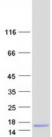 Coomassie blue staining of purified DYNLL1 protein