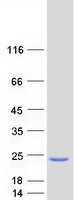 Coomassie blue staining of purified SKP1 protein