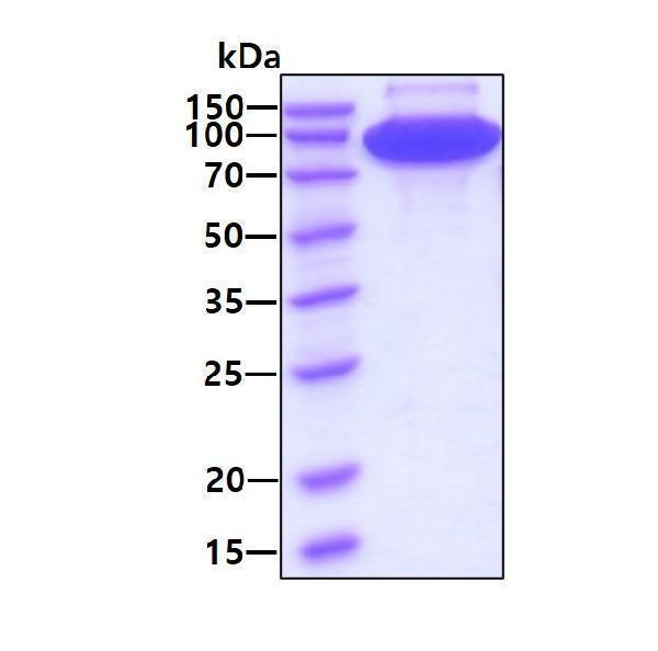 3ug by SDS-PAGE under reducing condition and visualized by coomassie blue stain