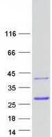 Coomassie blue staining of purified NKX3-2 protein
