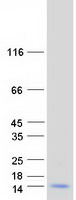 Coomassie blue staining of purified MT1H protein