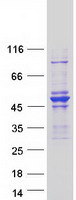 Coomassie blue staining of purified ARHGAP8 protein