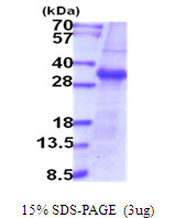 protp98073 sdspage human enteropeptidase enterokinase recombinant protein