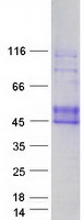 Coomassie blue staining of purified EFNB1 protein