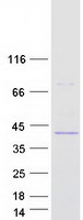 protp98198 atp8b2 human recombinant protein
