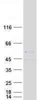 Coomassie blue staining of purified SLC25A3 protein