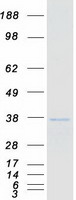 Coomassie blue staining of purified GTF2B protein