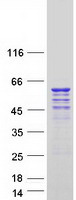 Coomassie blue staining of purified CDK16 protein