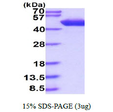 3ug by SDS-PAGE under reducing condition and visualized by coomassie blue stain