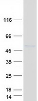 Coomassie blue staining of purified IL5RA protein