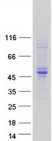 protq01415 galk2 human recombinant protein