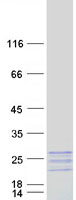 protq01449 myl7 human recombinant protein