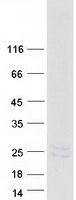 Coomassie blue staining of purified PMP22 protein