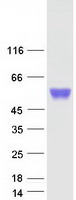 protq01459 ctbs human recombinant protein
