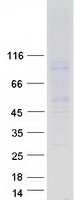 Coomassie blue staining of purified MC2R protein