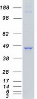 protq01973 ror1 human recombinant protein
