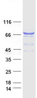 Coomassie blue staining of purified GUCY1A1 protein
