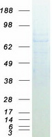 Coomassie blue staining of purified GUCY1B1 protein