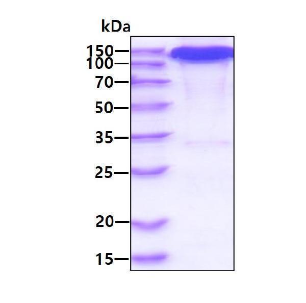 3ug by SDS-PAGE under reducing condition and visualized by coomassie blue stain