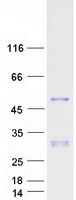 protq02962 pax2 human recombinant protein