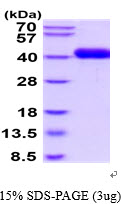 3ug by SDS-PAGE under reducing condition and visualized by coomassie blue stain.