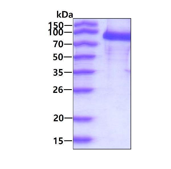 3ug by SDS-PAGE under reducing condition and visualized by coomassie blue stain