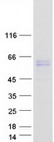 Coomassie blue staining of purified ACVR1 protein